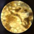 Actinobacteria unidentified-2.JPG