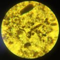 Actinobacteria unidentified-1.JPG