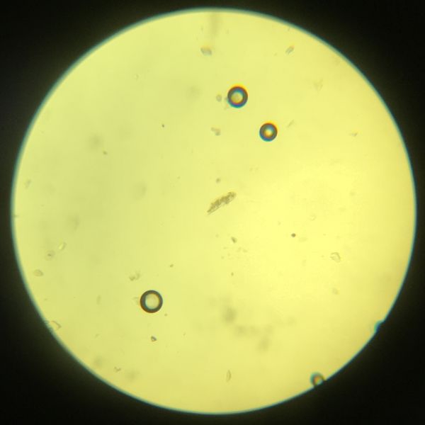 File:Rotifera-phylum unidentified.jpg