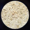 Nematode-remains unidentified-2.JPG